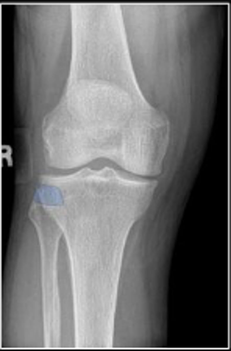 <p>What is outlined?</p>