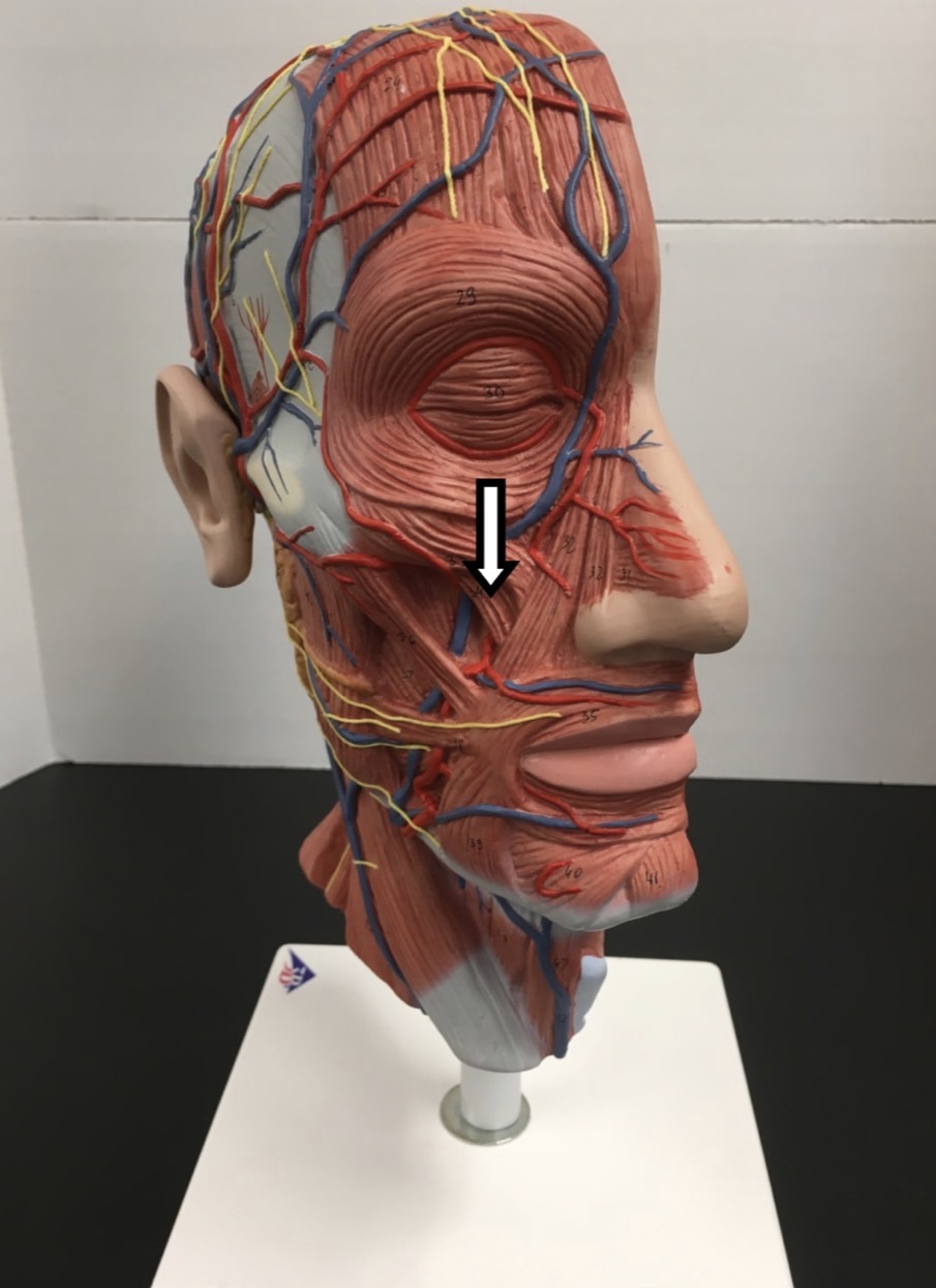 <p><span>Name the muscle labeled with the white arrow below:</span></p>
