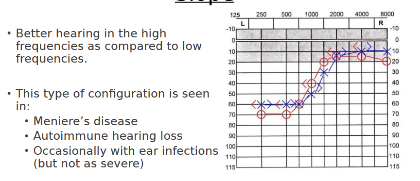 <p>“Severe through 500 Hz rising to normal at 1500 Hz hearing loss”</p>