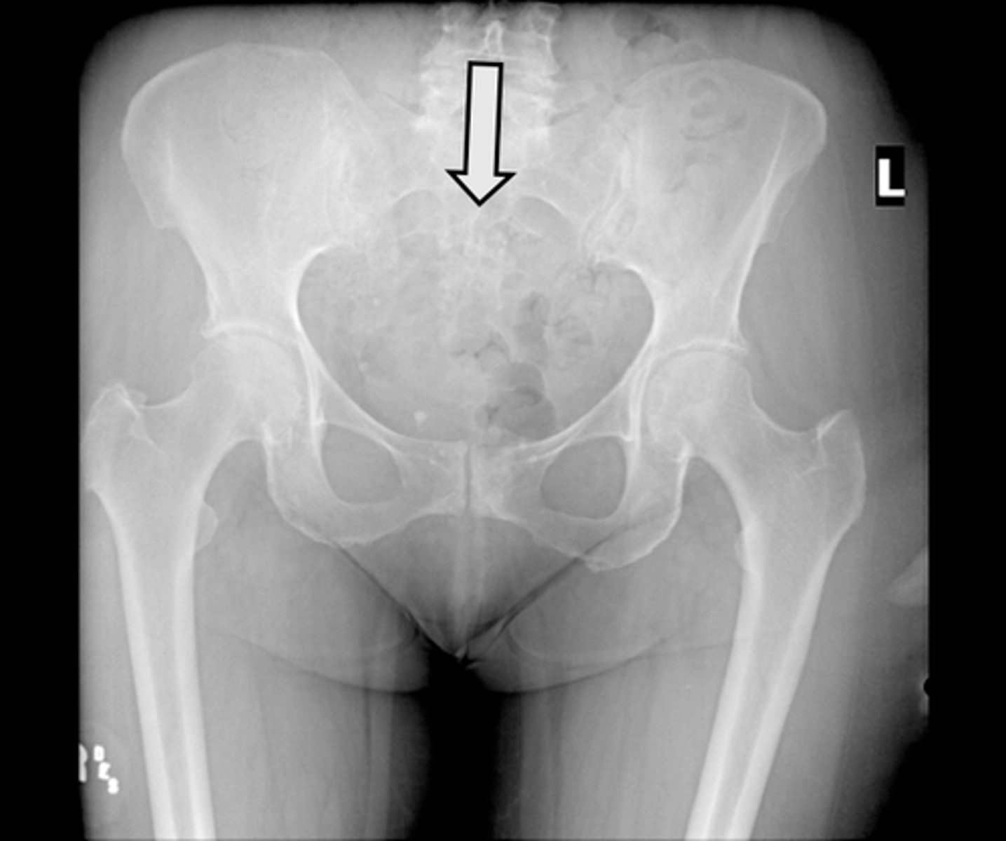 <p>What is indicated in the image?</p>