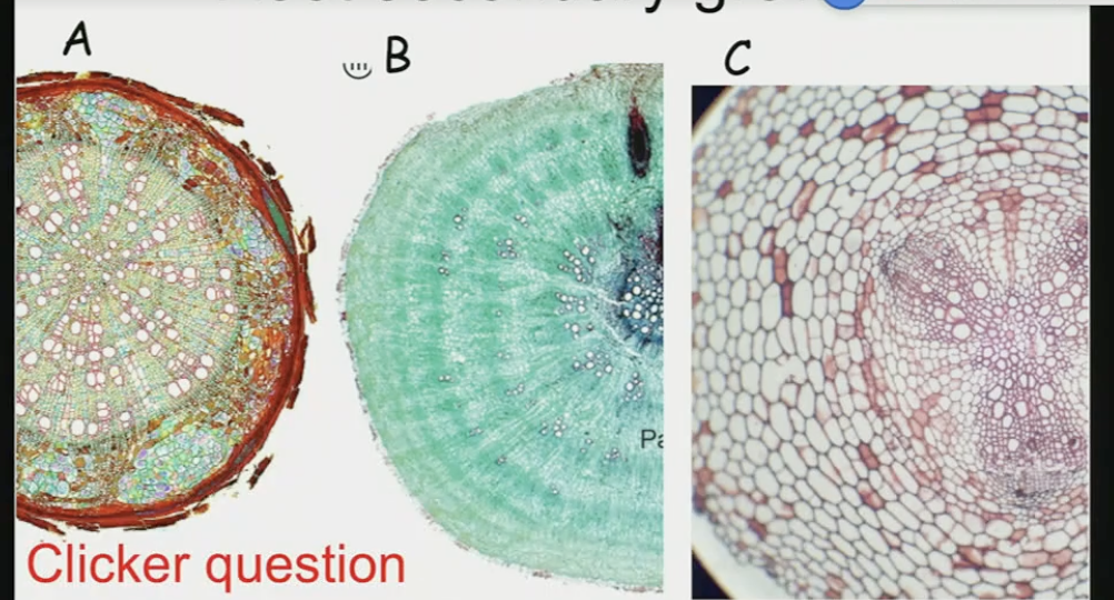 <p>which of these roots is showing normal secondary growth</p>