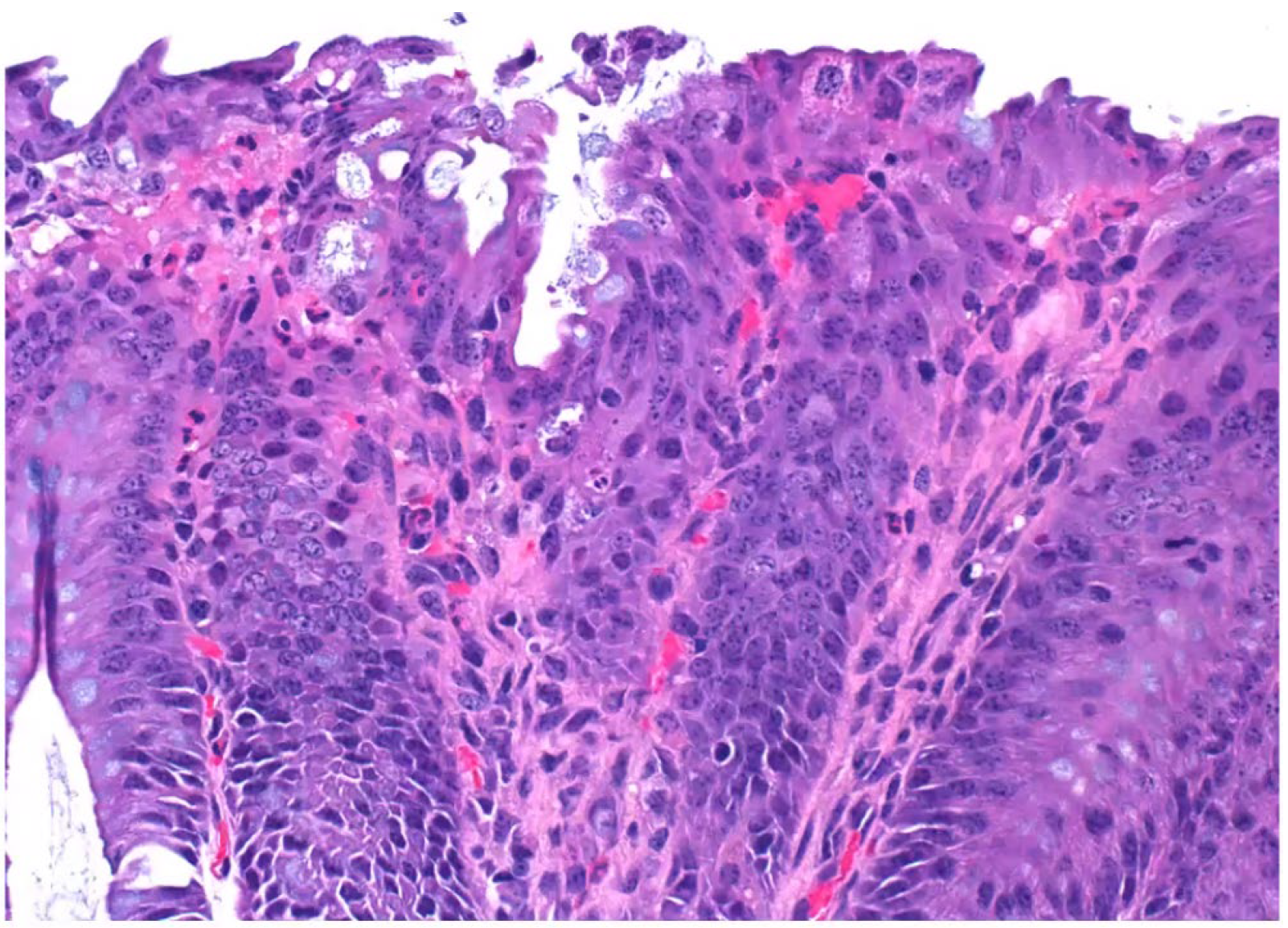 <p>Calf. What is the condition?</p><p>A-Enterotoxigenic colibacillosis</p><p>B-Coccidiosis</p><p>C-Cryptsporid iosis</p><p>D-Attaching effacing colibacillosis</p>