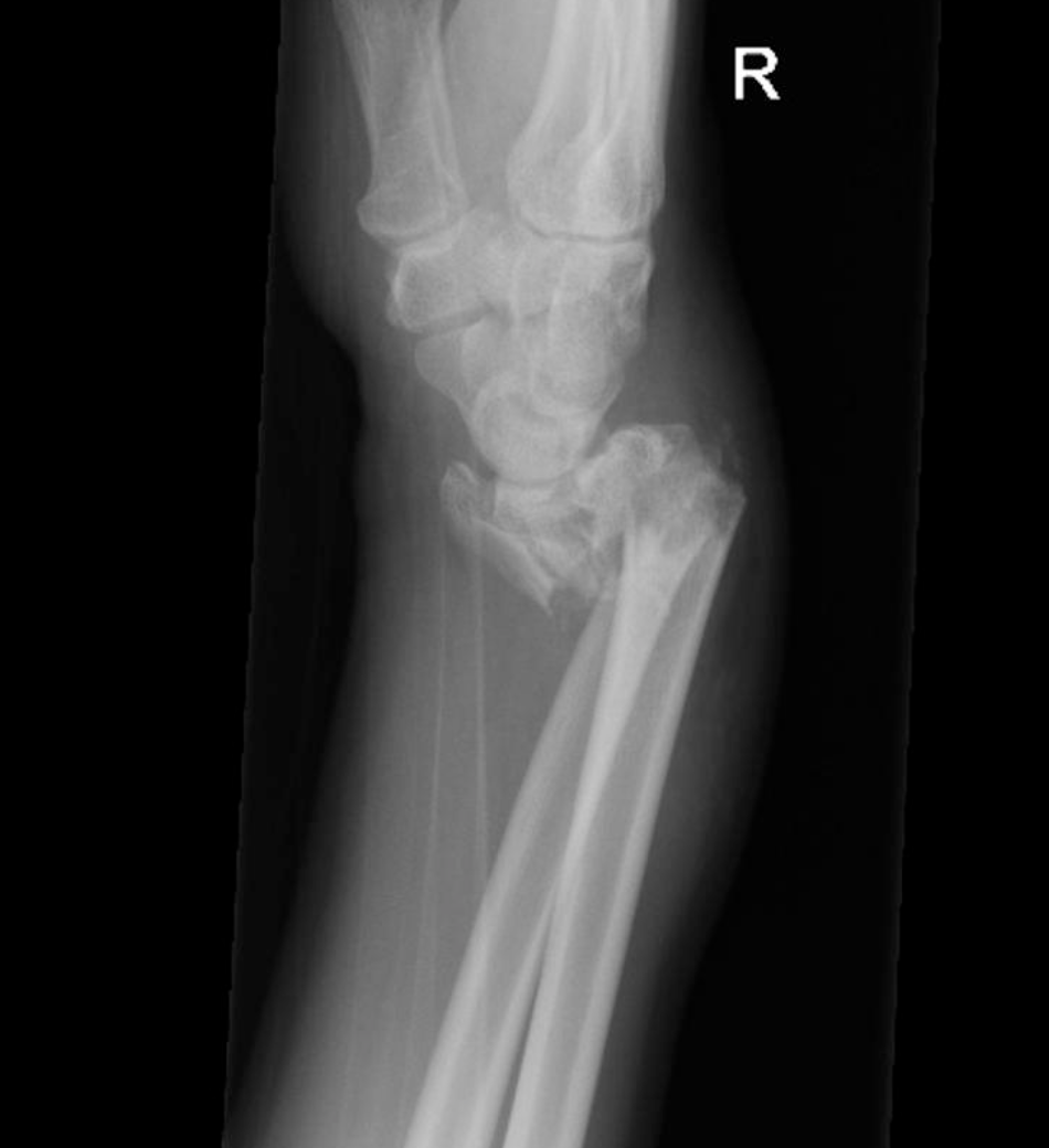 <p>What type of injury is this?</p>