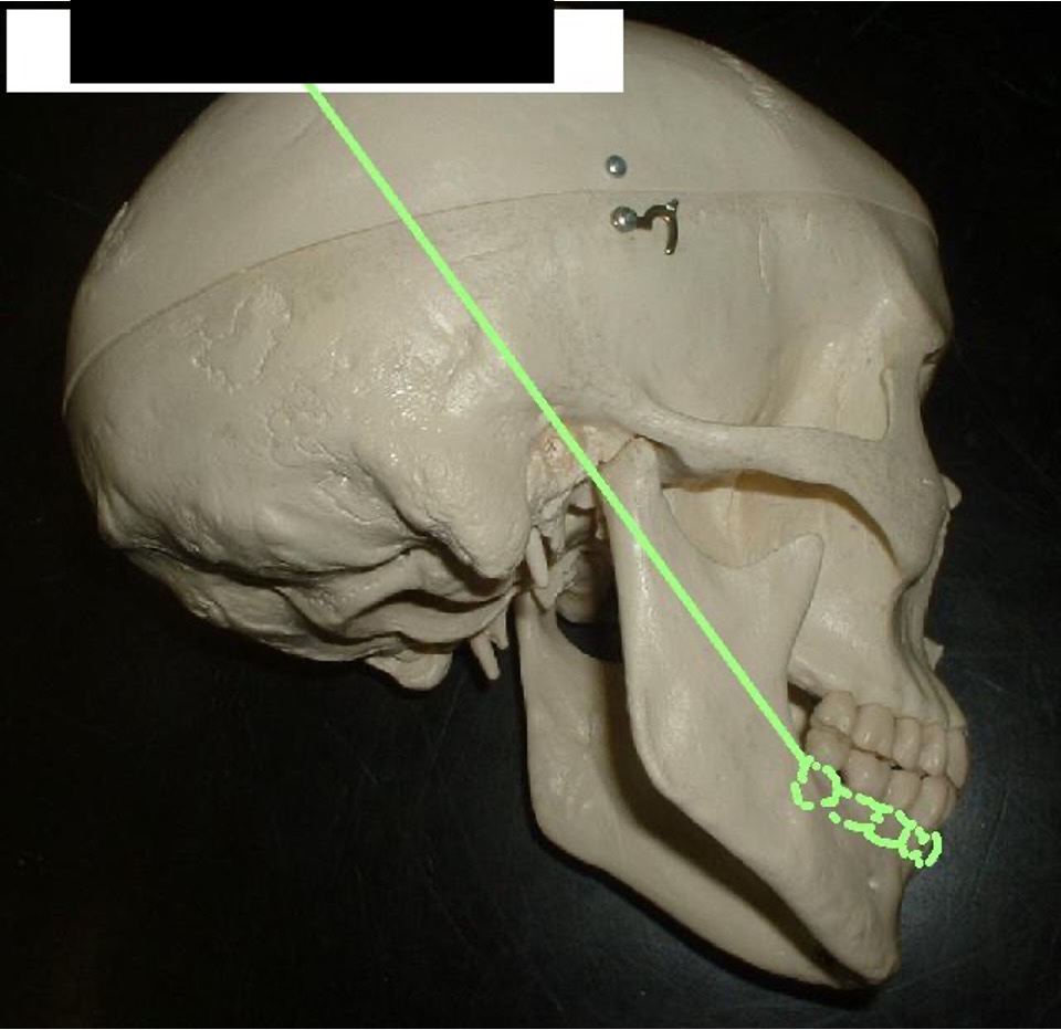 <p>where the teeth connect to the lower jaw.</p>