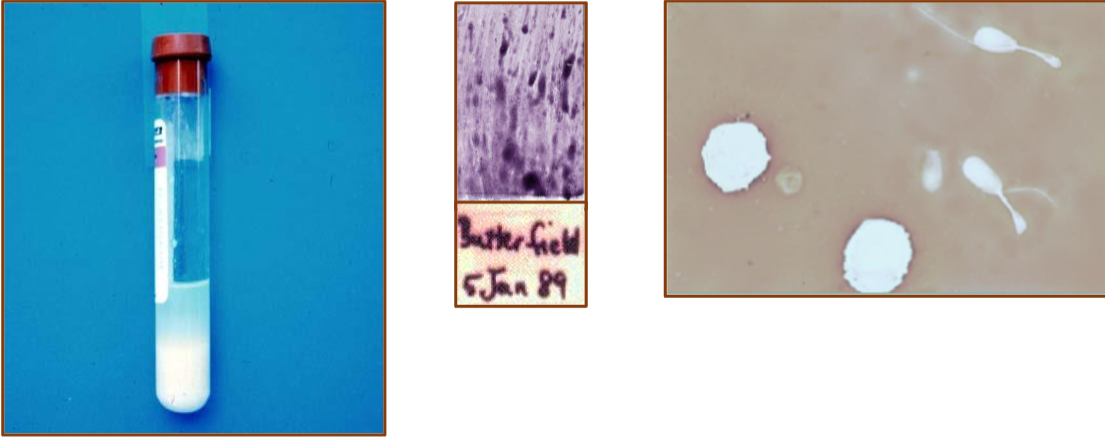 <p>What are these?</p><p>What does it signify?</p>