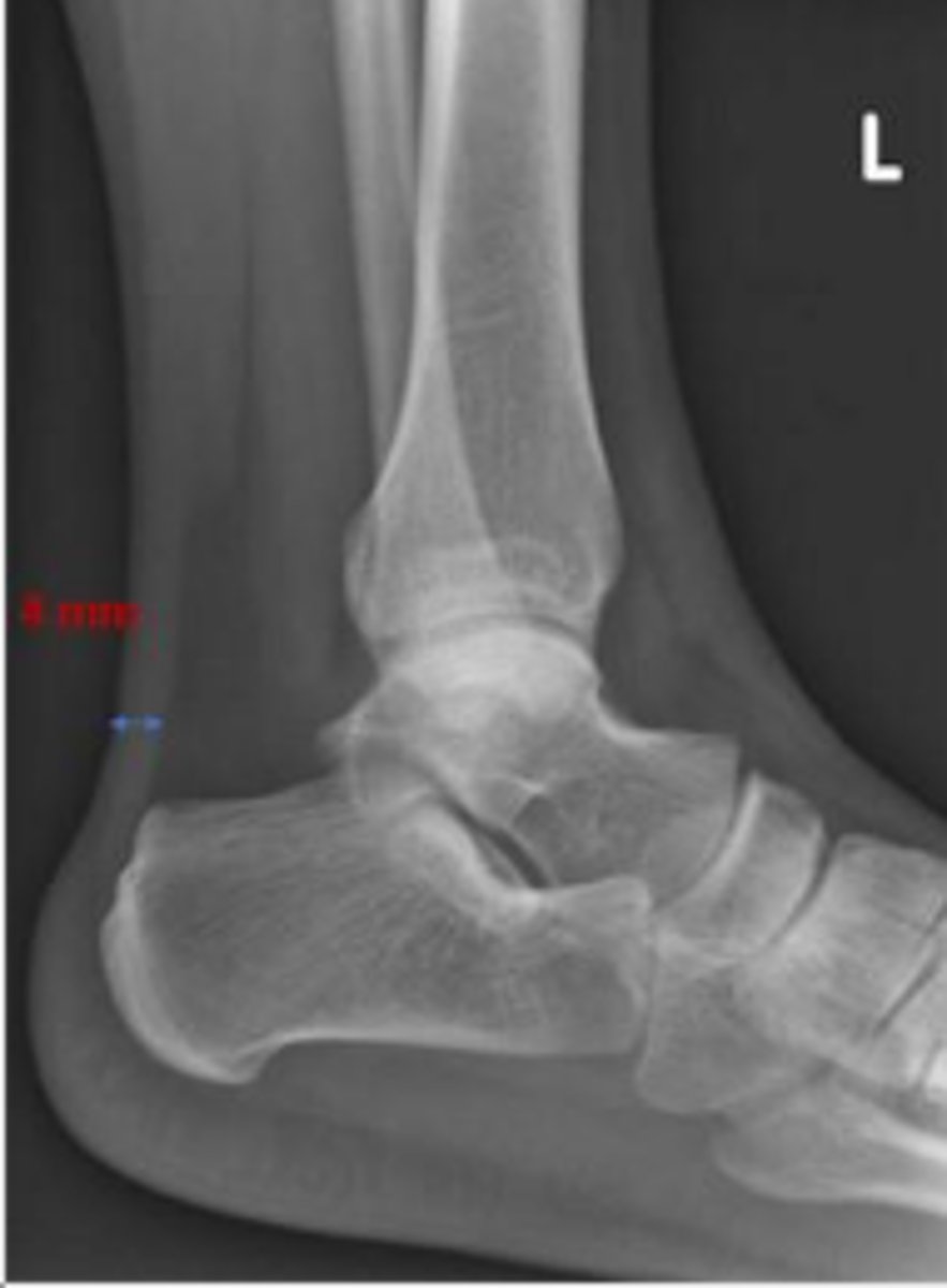 <p>Is the assessment within normal limits?</p>