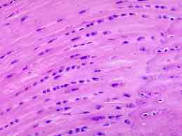 <p><span style="color: rgb(191, 191, 191)">transitional tissue that derives from mesenchymal tissue that lacks a perichondrium and has structural and functional properties between that of dense fibrous connective tissue and hyaline cartilage.</span></p>