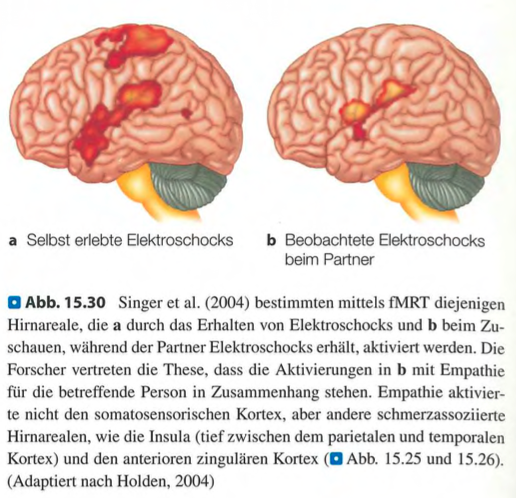 <p class=""><strong>Kurzfassung:</strong><br><strong>Empathie für Schmerz</strong> aktiviert im Gehirn <strong>ähnliche Regionen</strong> wie eigener Schmerz – insbesondere <strong>Insula</strong> und <strong>anteriorer zingulärer Kortex</strong>. Auch <strong>Beobachtung von Berührung</strong> ruft Aktivität im <strong>somatosensorischen Kortex</strong> hervor. <strong>Empathie ist trainierbar</strong> und basiert auf <strong>überlappenden neuronalen Mechanismen</strong>.</p><div data-type="horizontalRule"><hr></div><p class=""><strong>Langfassung:</strong></p><ul><li><p class=""><strong>Empathie für Schmerz anderer (Singer et al., 2004):</strong></p><ul><li><p class="">Wenn Frauen sehen, wie ihre Partner <strong>Elektroschocks</strong> erhalten, aktivieren sich bei ihnen dieselben Hirnregionen wie bei <strong>eigener Schmerzwahrnehmung</strong>:</p><ul><li><p class=""><strong>Anteriore zinguläre Kortex</strong></p></li><li><p class=""><strong>Insula</strong></p></li></ul></li><li><p class="">Die Stärke der Aktivierung hängt mit der <strong>individuellen Empathiefähigkeit</strong> zusammen.</p></li></ul></li></ul><p class=""></p><ul><li><p class=""><strong>Empathie bei Berührungsbeobachtung (Keysers et al., 2004):</strong></p><ul><li><p class="">Das <strong>Beobachten</strong> von <strong>Berührungen anderer</strong> aktiviert <strong>somatosensorische Kortexareale</strong>, die sonst auf eigene Berührung reagieren.</p></li><li><p class="">Dies zeigt eine <strong>geteilte neuronale Repräsentation</strong> von Erleben und Beobachtung.</p></li></ul></li></ul><p class=""></p><ul><li><p class=""><strong>Empathietraining (Klimecki et al., 2014):</strong></p><ul><li><p class=""><strong>Videos mit leidenden Menschen</strong> erhöhen die Aktivität im <strong>anterioren zingulären Kortex</strong>.</p></li><li><p class="">Ergebnis: <strong>Gesteigerte Empathie</strong> durch wiederholtes Training.</p></li></ul></li></ul><p class=""></p><ul><li><p class=""><strong>Schlussfolgerung:</strong></p><ul><li><p class="">Die <strong>Beobachtung von Schmerz</strong> bei anderen wird <strong>nicht nur visuell</strong>, sondern auch <strong>emotional und physiologisch</strong> verarbeitet.</p></li><li><p class="">Schmerzempfinden und Mitgefühl teilen <strong>gemeinsame neuronale Netzwerke</strong> – besonders in <strong>affektiven Hirnregionen</strong>.</p></li></ul></li></ul><p></p>