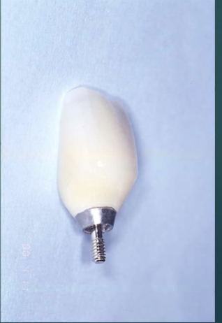 <p>good emergence profile?</p>