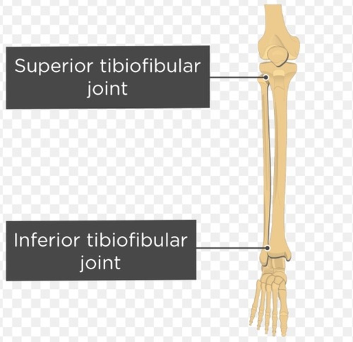<p>-head of fibula (LM)</p><p>-lateral condyle of tibia (LM)</p><p>-synovial (SC)</p><p>-plane (ST)</p>