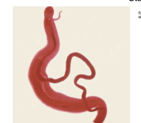 <p>what parasite is this and gender?</p>