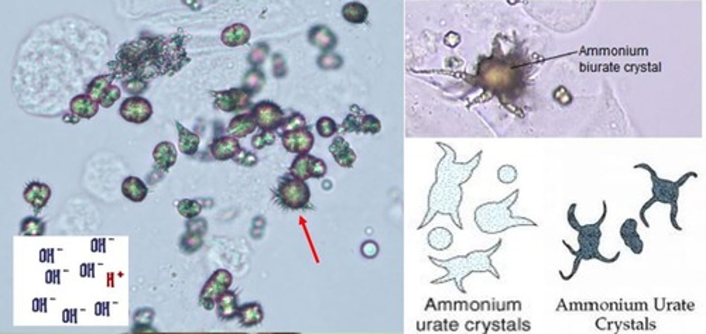 <p>Ammonium biurate</p><p>-Seen in old specimen</p>
