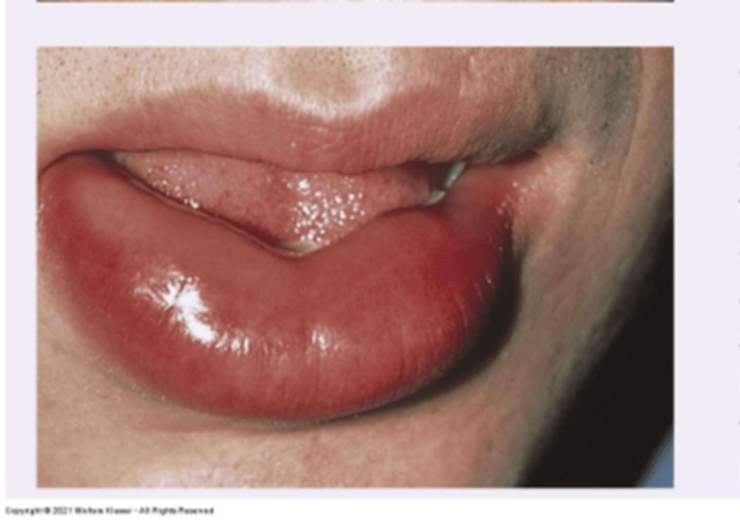 <p>Diagnosis?</p>