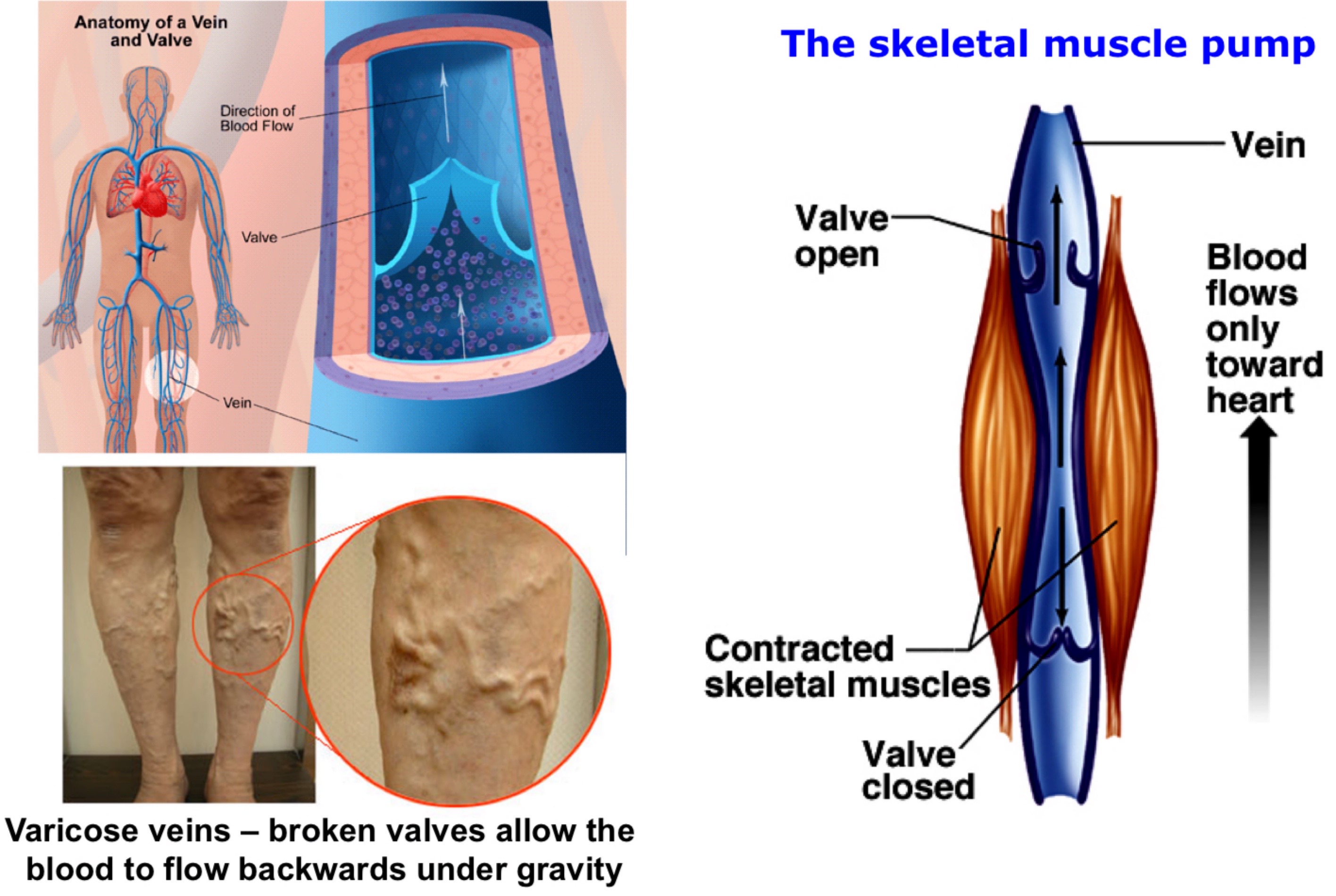 <ul><li><p>Facilitated by valves and the skeletal muscle pumps</p></li><li><p>Veins runs close in the skeletal muscle</p></li><li><p>Blood flow back as you move around. Muscles moving squeezes veins pushes blood up towards the heart</p></li></ul>