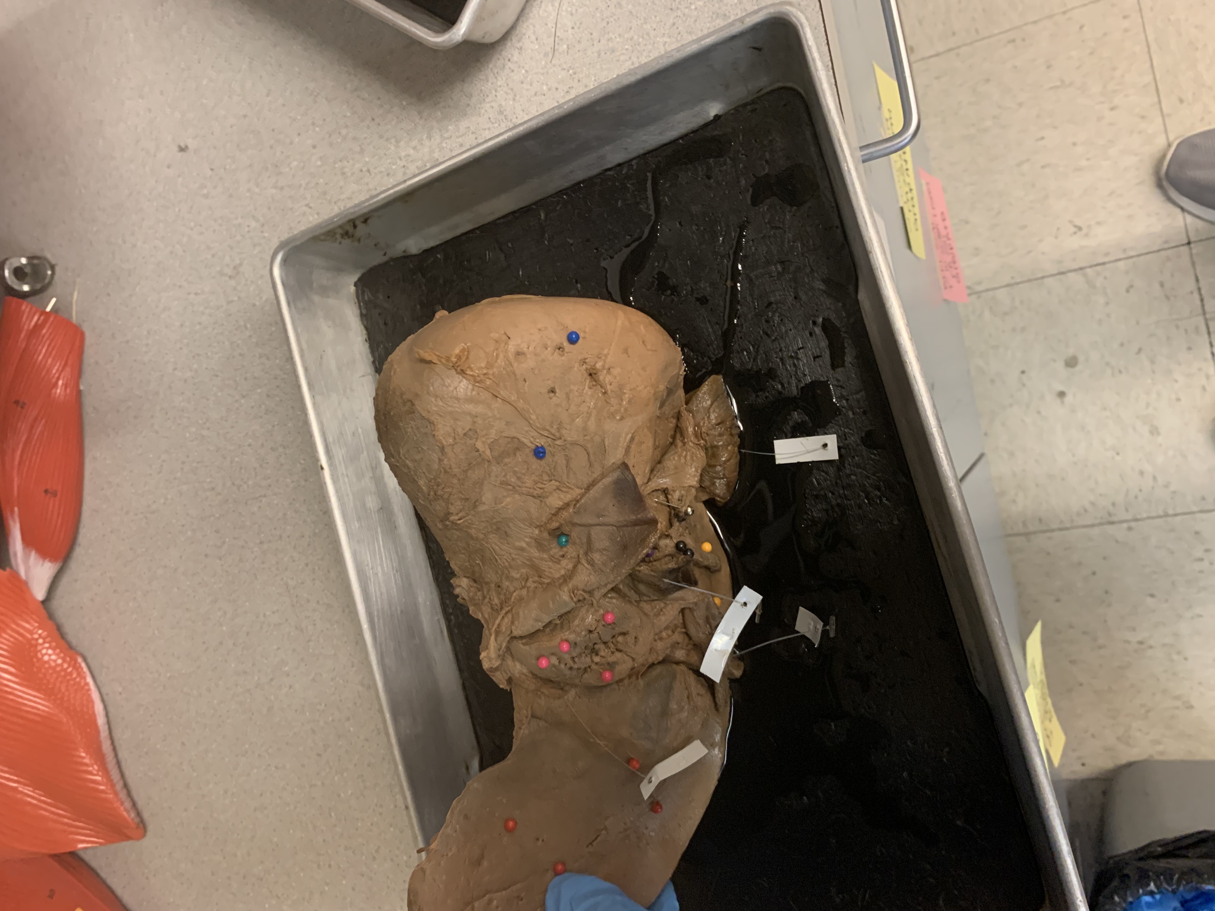 <p>Dark blue pins </p>