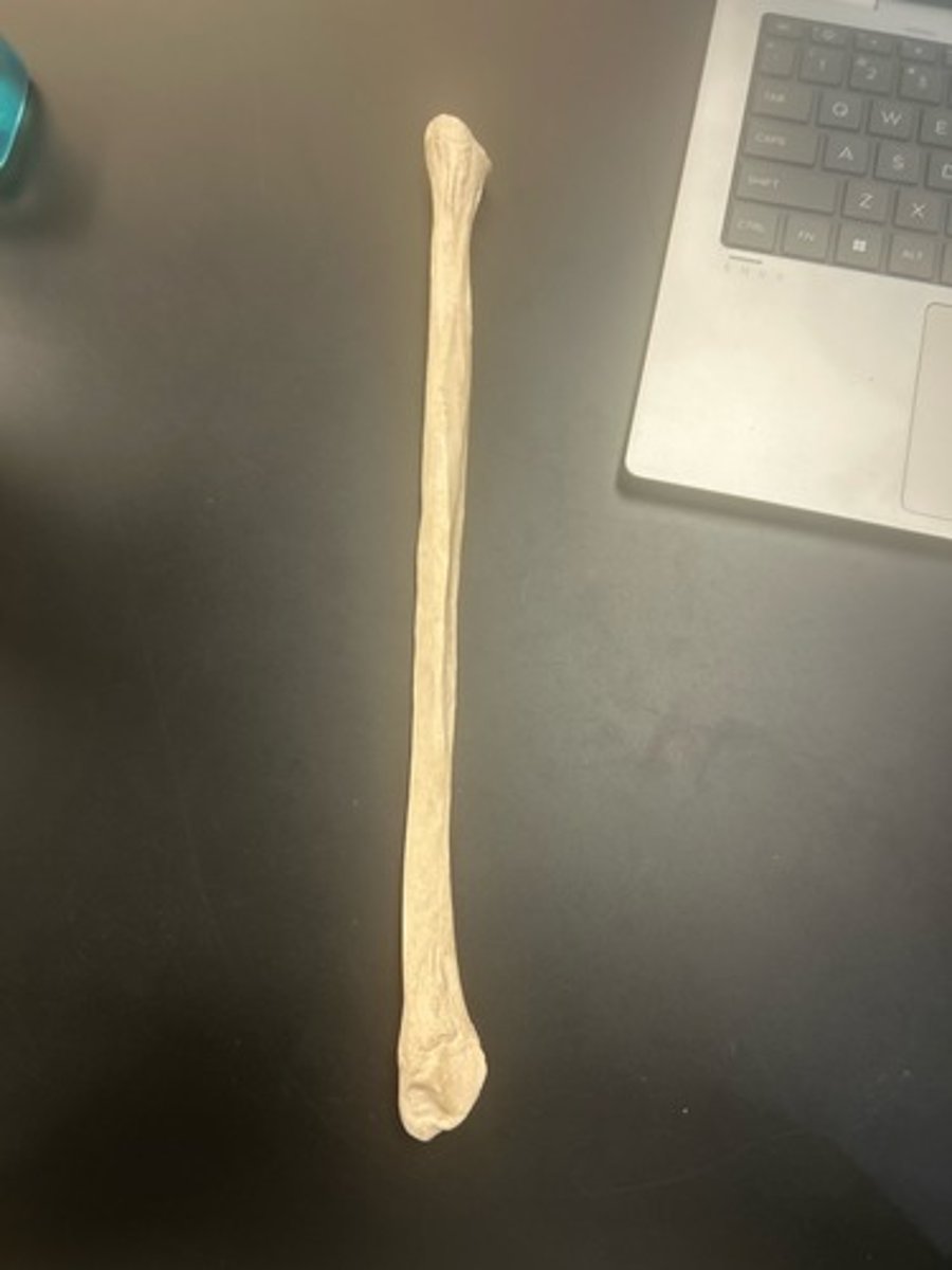 <p>name the bone</p>