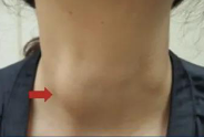 <p>Neck </p>
