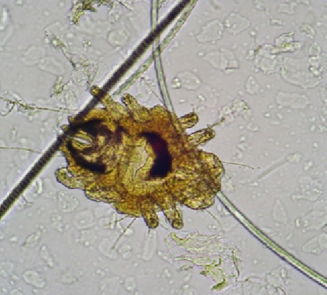 <p>Cheyletiella - surface-dwelling mite. feeds on keratin. walking dandruff</p>