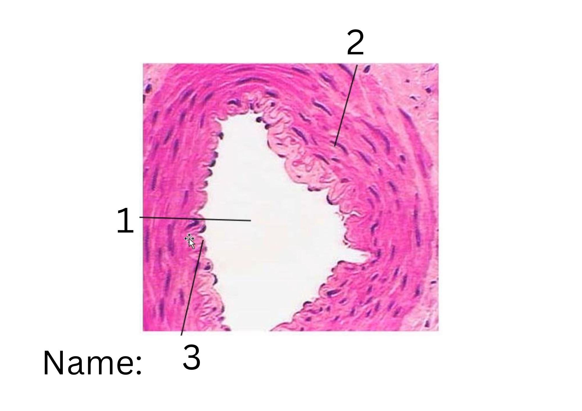 term image