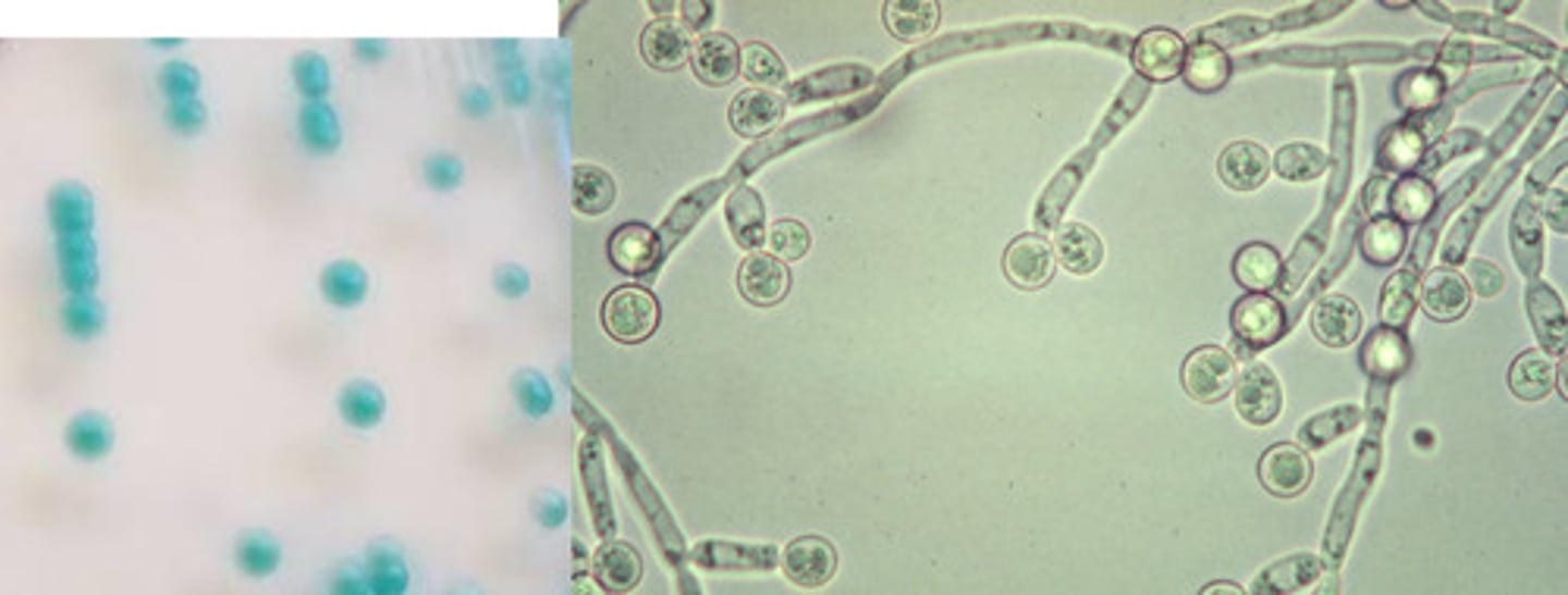 <ul><li><p>Germ tube +</p></li><li><p>BBL: Teal</p></li></ul><p></p>