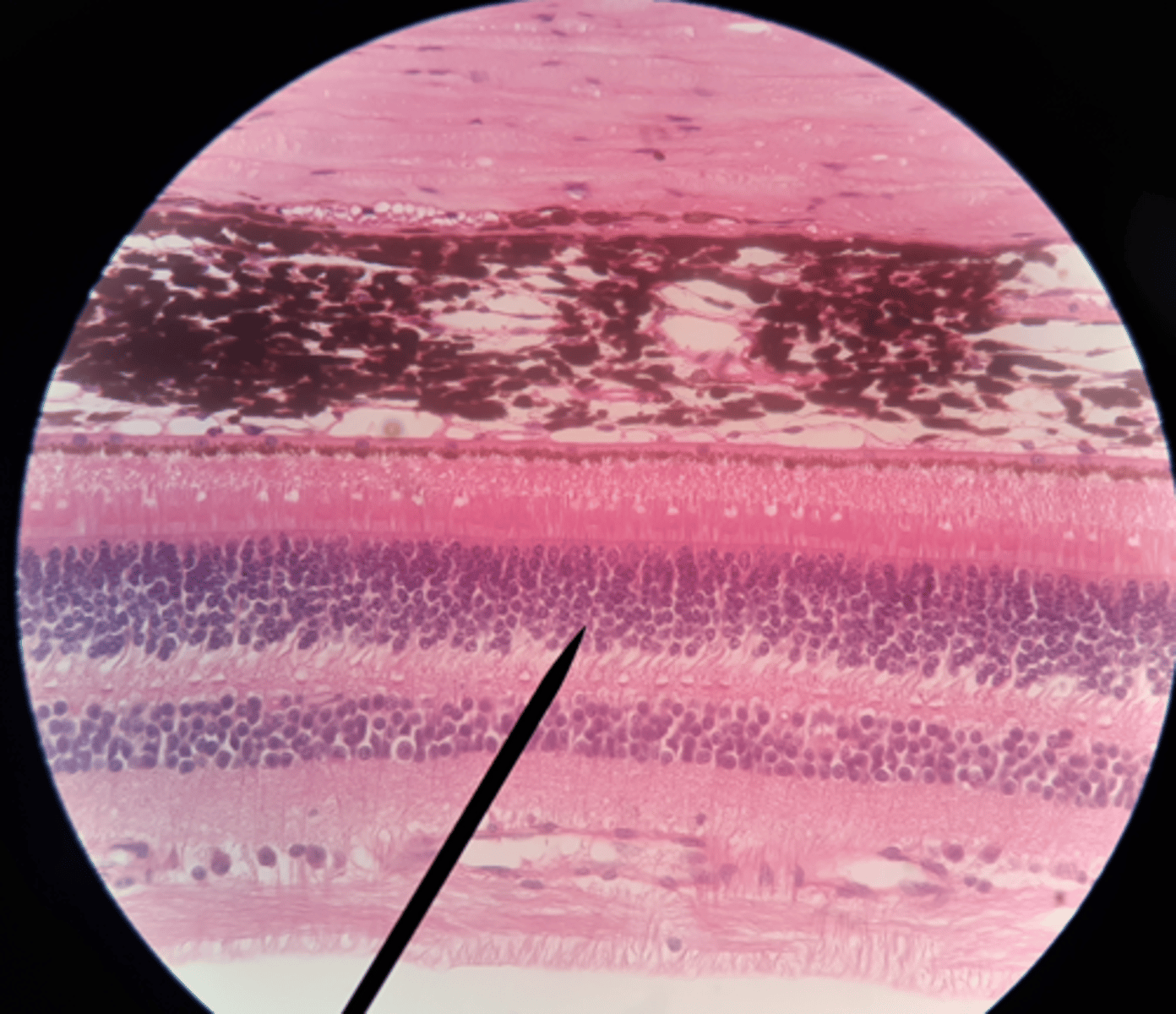 <p>Special: Vision</p><p>tissue structure located on the inner part of the posterior eyeball, just anterior to the choroid; contains the cells involved in the visual pathway. Involves six main layers from posterior to anterior: pigmented layer (rods and cones), outer synaptic layer, bipolar layer, inner synaptic layer, ganglion cell layer, optic (II) nerve axons</p>