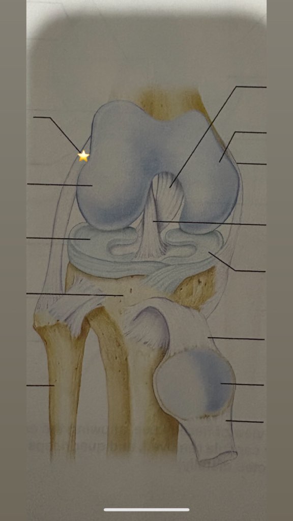 <p>Name the starred structure</p>