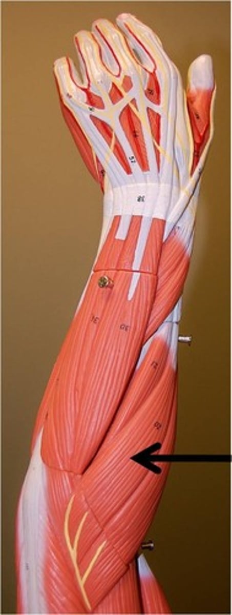 <p>What is this muscle (directly to the right is the brachialis)</p>