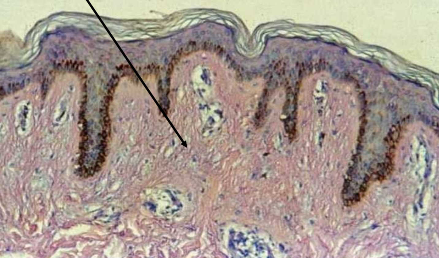 <p>Where are dense, irregular connective tissues found?</p>