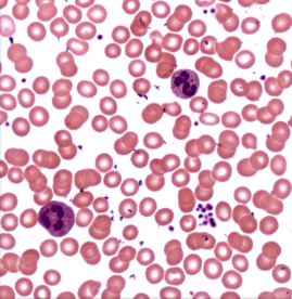<p>Label the erythrocytes, neutrophils, and platelets: </p>