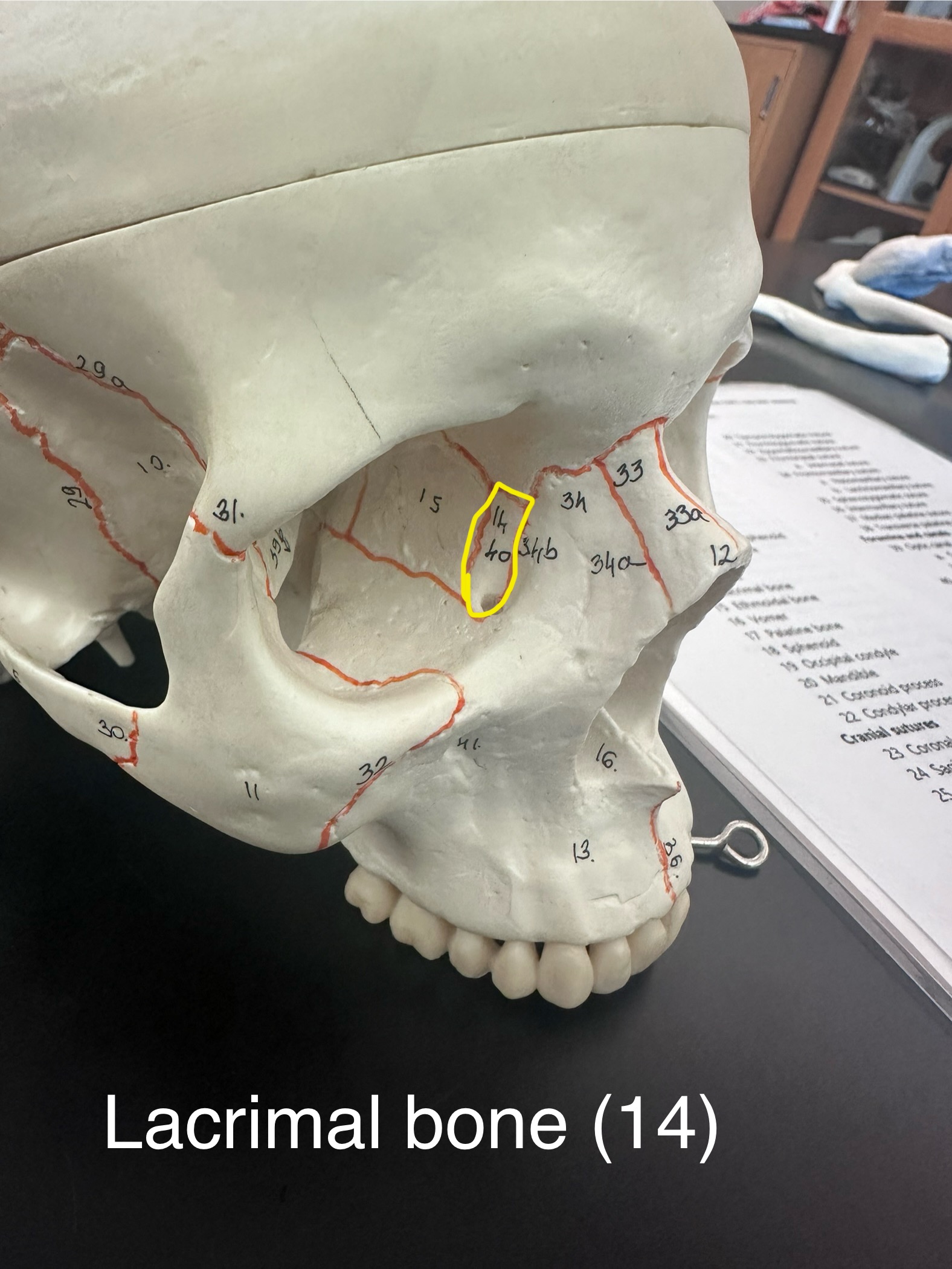 <p>Lacrimal Bone</p>