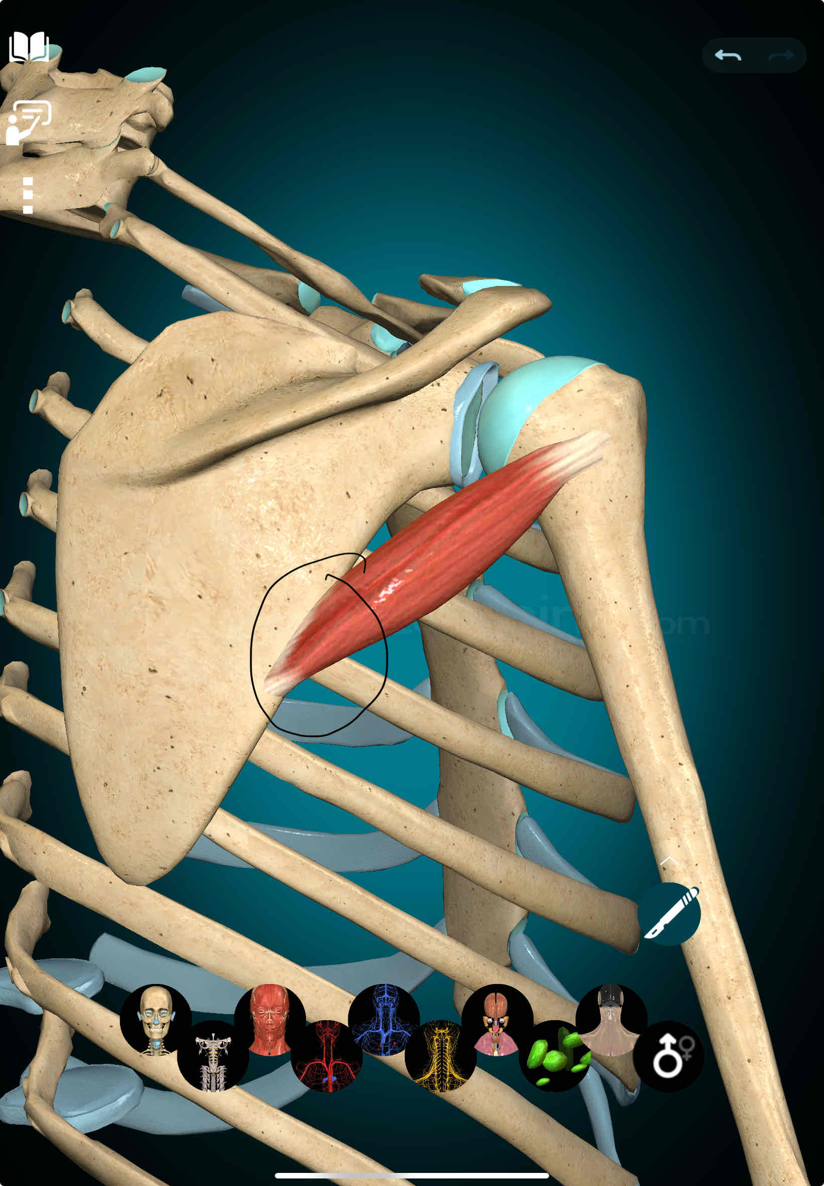 <p>Teres Minor Origin</p>