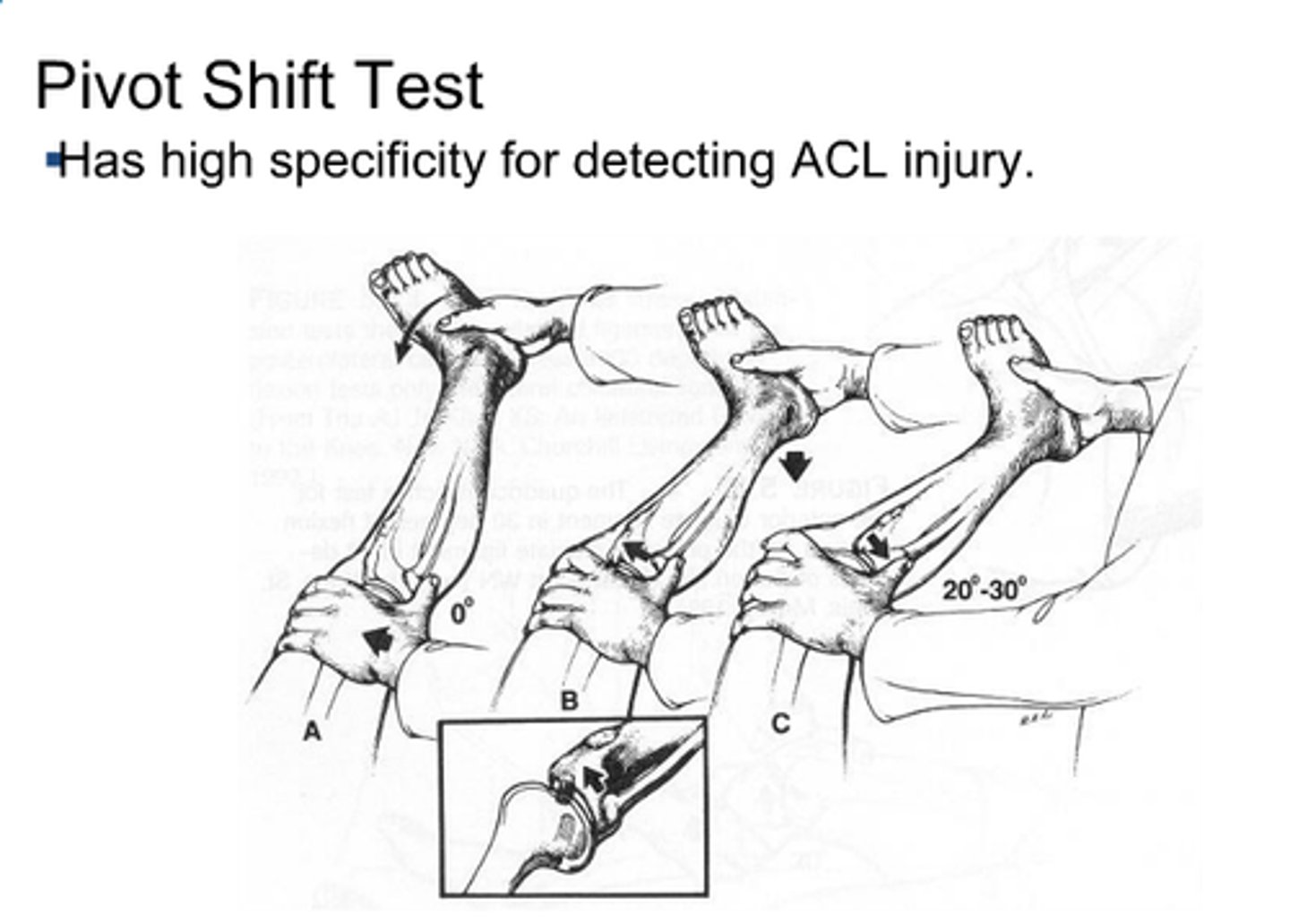 <p>Anterior cruciate ligament integrity</p>