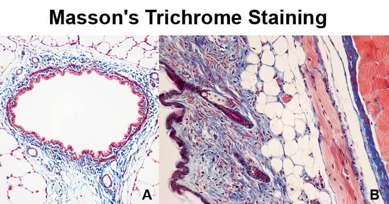 <ul><li><p>comprise three different dyes </p></li><li><p>to stain different components in different colours</p></li></ul><p></p>