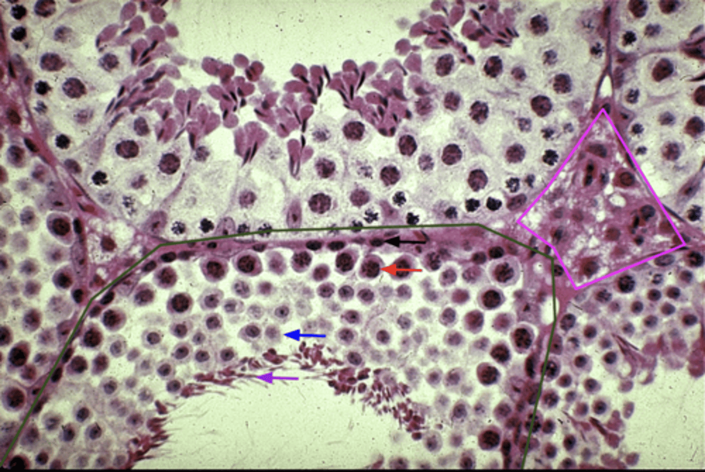 <p>What is the pink outline?</p>