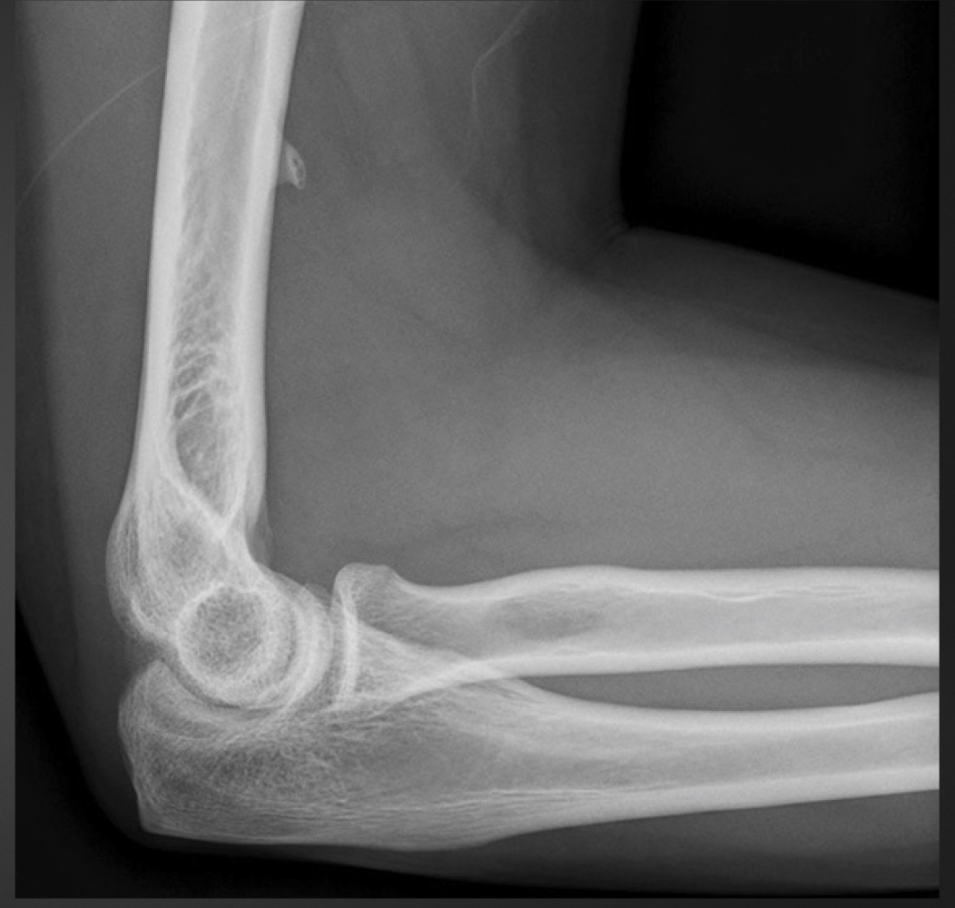 <p>what is this anomaly called </p>