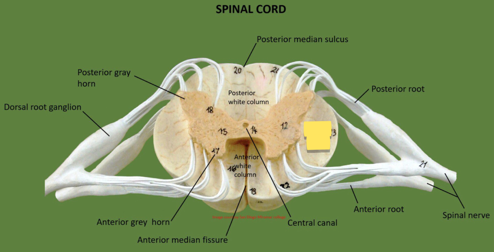 <p>Name this spinal cord part</p>
