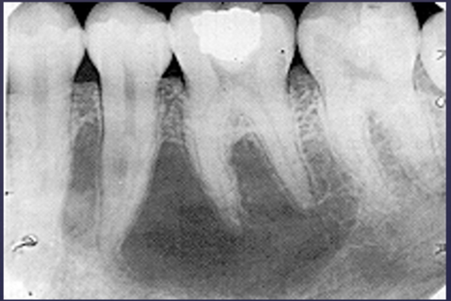 <p>What category would this lesion be part of?</p>