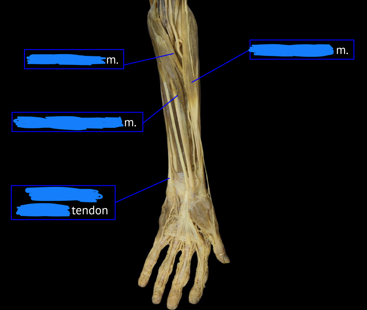 <p>top left muscle</p>