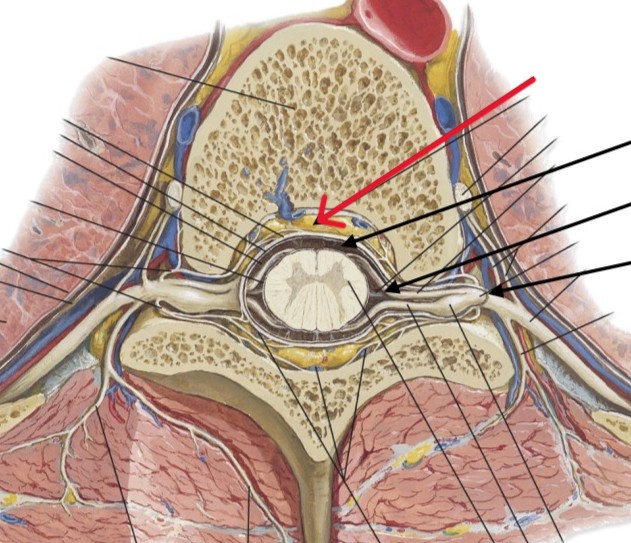 <p>Which part of the spinal cord is:</p><ul><li><p>Looks like yellow fat</p></li></ul><p></p>