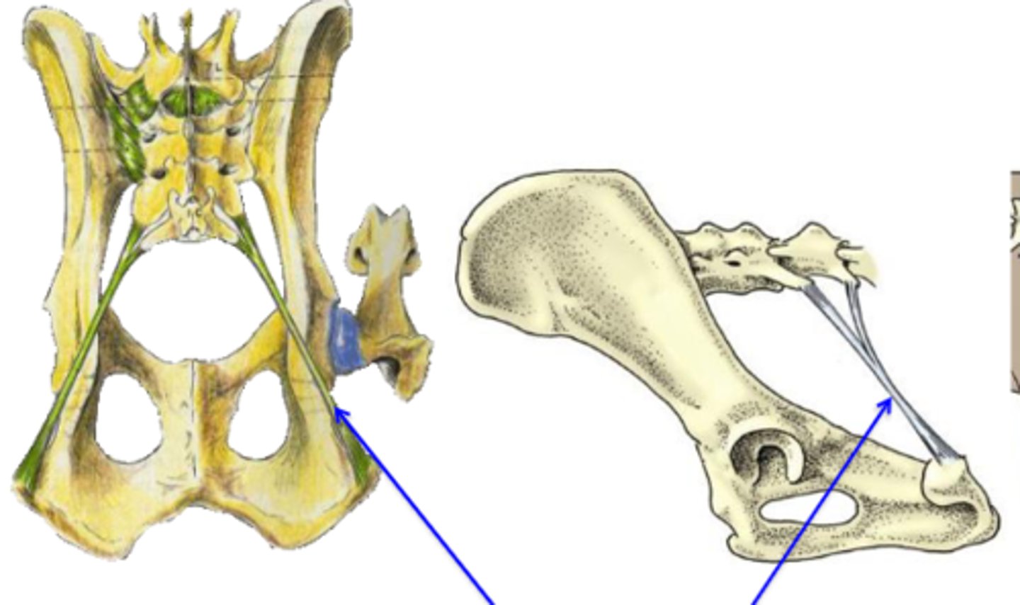 <p>What are the blue arrows pointing to?</p>
