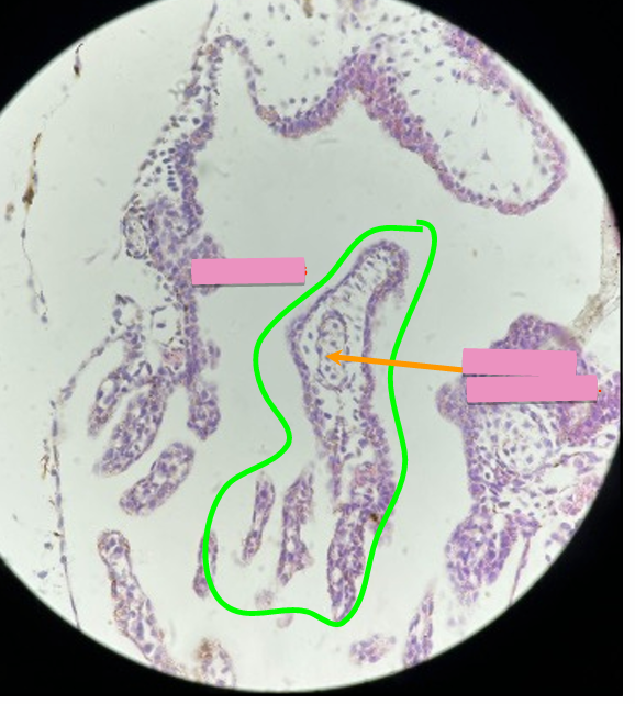 <p>what level<br>primary brain vesicle<br>parts</p>