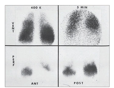 <p>It involve the administration of oral, parenteral, or inhaled radioactive chemicals or pharmaceuticals. X-ray images, usually serial, record the collection and dispersion of the radioactive material</p>