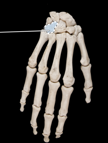 <p>Bones of the hand, posterior view, right side</p>