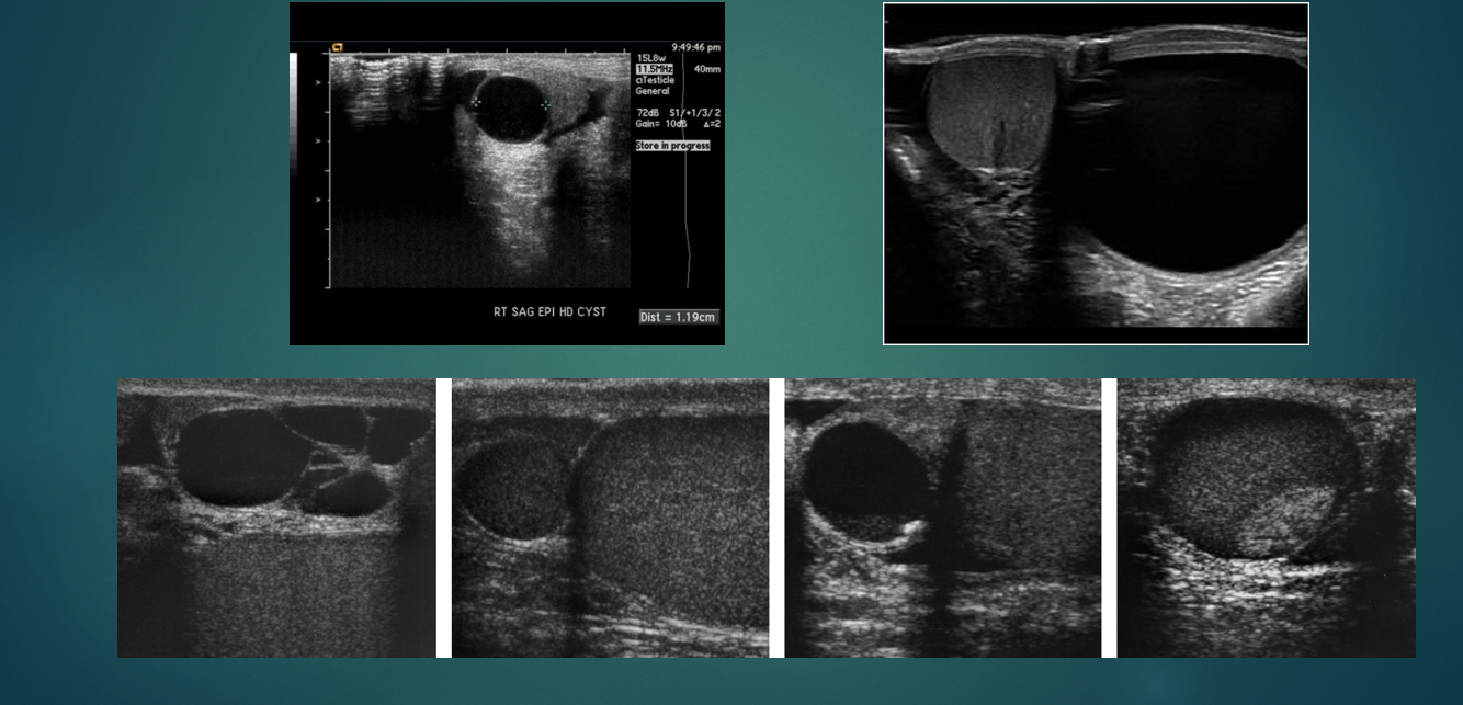 <p>what do this images show</p>