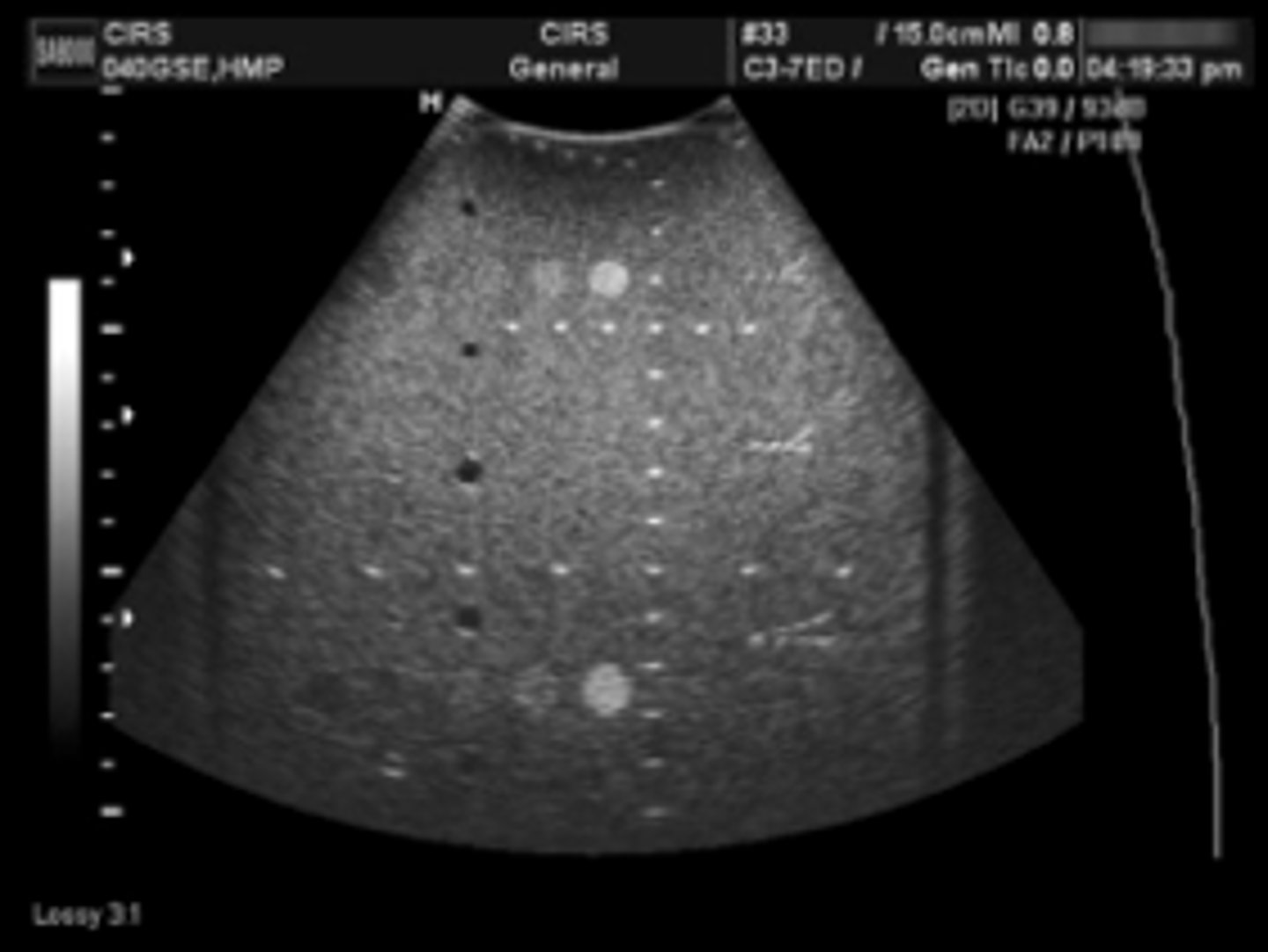 <p>Using a tissue equivalent phantom</p>