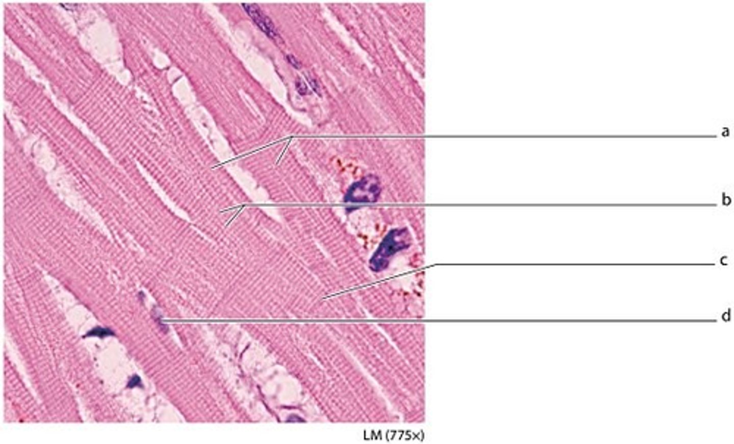 <p>cardiac muscle fibers</p>