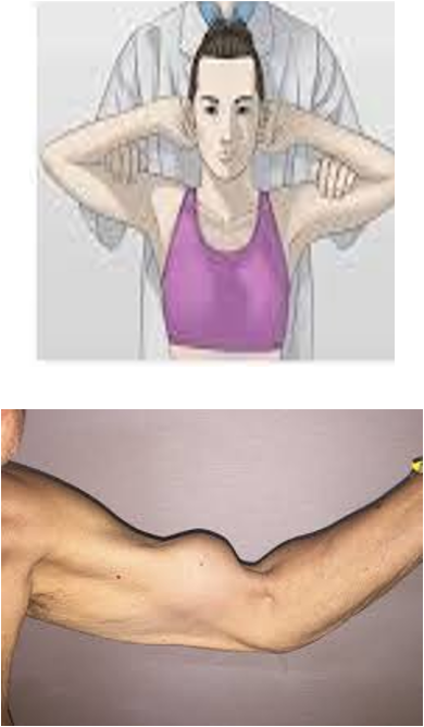 <ul><li><p>test for torn head of biceps</p></li><li><p>pt sitting, clasp hands behind head → ask pt to contract biceps </p></li><li><p>positive = no contraction is palpable </p></li></ul><p></p>