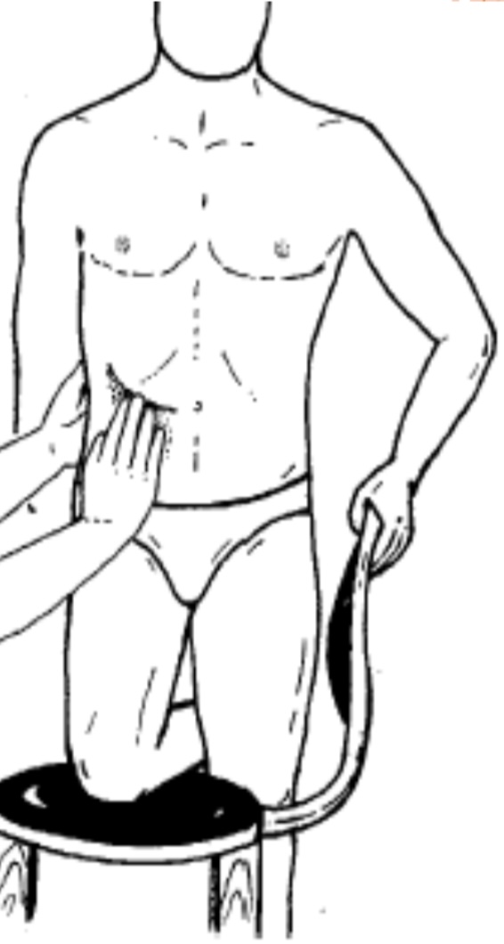 <p>Se coloca el paciente en posición erguida.</p><p>Se le invita a apoyar la rodilla flexionadas sobre el asiento de una silla puesta de costado, con la mano del lado opuesto sobre el respaldo.</p><p>El médico, sentado, se coloca frente al enfermo o al lado de él.</p><p>Las manos se disponen como en el procedimiento de Israel.</p>