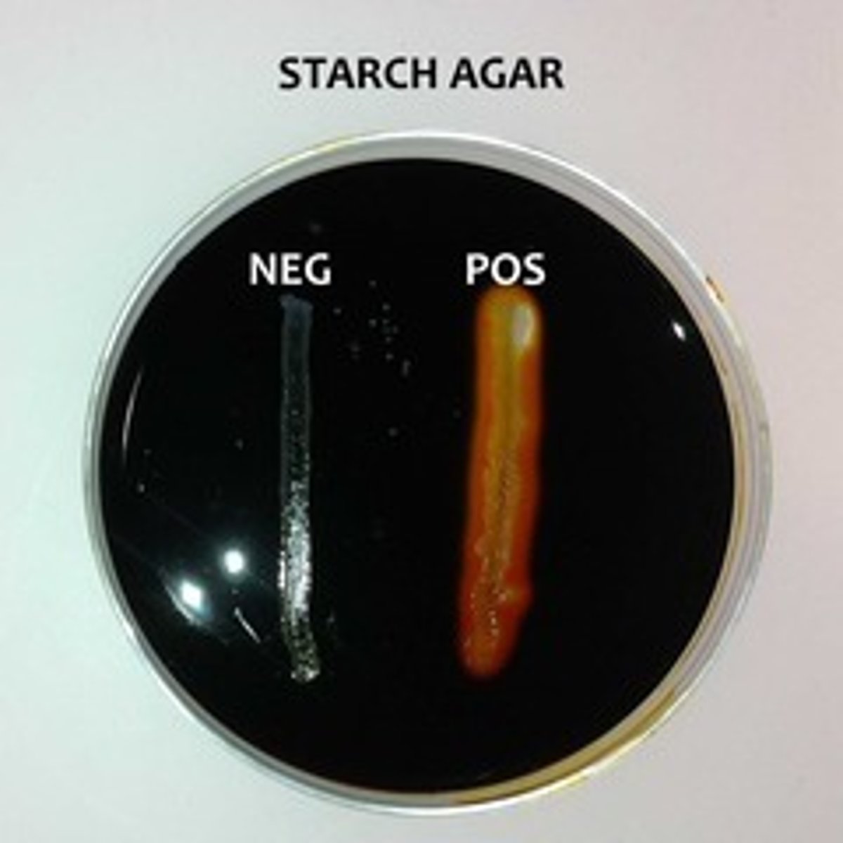 <p>amylase</p>