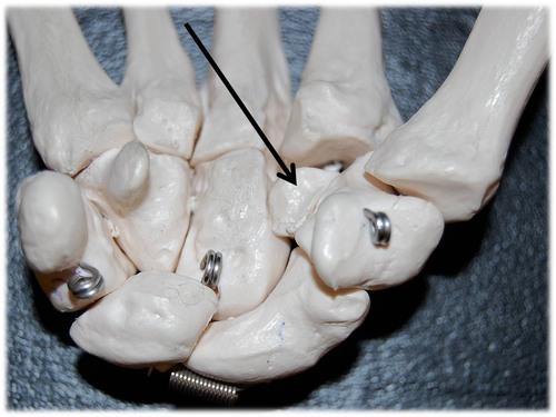 Name this specific bone of the hand (anterior view).